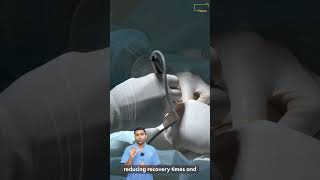 What is a spine surgery operating microscope [upl. by Holsworth]