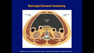 02 Retroperitoneal Spaces Anatomy and Disease Spread [upl. by Hbahsur]