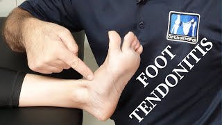 Tibialis Anterior Tendonitis Top of the Foot Pain [upl. by Yrian697]