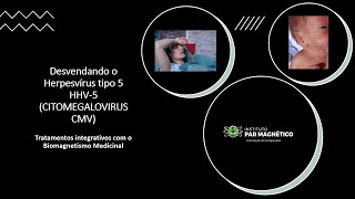 Desvendando o Herpesvírus 5 CITOMEGALOVIRUS  Tratamentos integrativos com Biomagnetismo Medicinal [upl. by Dessma396]