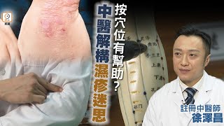 【oncc東網】【你要知：濕疹痕癢難頂 中醫教路按穴位可止痕】 [upl. by Armand]