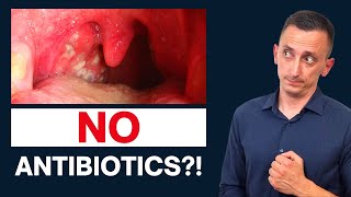 Antibiotics for Strep Throat Do We Need Them [upl. by Asile]