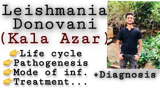 Leishmania donovani  life cycle  diagnosisTreatment etc Leishmania Leishmaniasis Parasitology [upl. by Adrian]