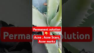 Acne Acne Scars Acne marks treatment  Clear skin megical home remedy viralvideo clearskin [upl. by Alix680]