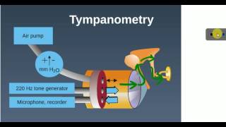 ENT LECTURES  Investigations  TYMPANOMETRY [upl. by Anale]