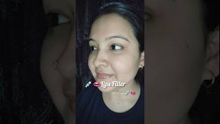 Lips Filler at home 👄 lips lipfiller shorts youtubeshorts skincare trendingshorts viralshorts [upl. by Argyres737]