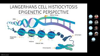 JCS 7 Langerhans cell histiocytosis [upl. by Kcered646]