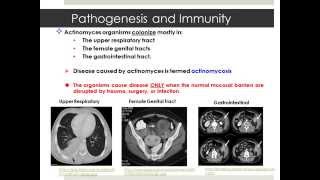 Actinomyces [upl. by Nnaecarg]