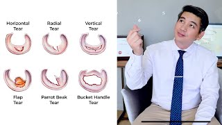 Meniscus tears can heal without surgery  Dr Kyle [upl. by Aruol]