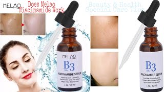 Melao B3 5 Niacinamide Serum ReviewDoes Melao Niacinamide Work [upl. by Enitsrik]