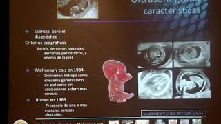 Dr Saulo Molina  Valoración integral de Hidrops Fetal [upl. by Ramhaj]