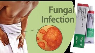 𝗙𝗨𝗡𝗚𝗔𝗟 𝗜𝗡𝗙𝗘𝗖𝗧𝗜𝗢𝗡fungalinfectionsathletesfootringwormtreatmentpsoriasisitchingproblemcandidb 💊 [upl. by Ttej]