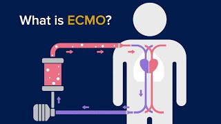 What is ECMO  Lifesaving Support for Failing Organs Including COVID19 Cases [upl. by Zobkiw959]