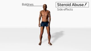 Side Effects of Steroids Abuse [upl. by Atnahs]