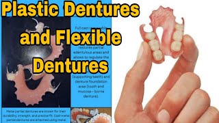 Plastic Dentures to Flexible Dentures [upl. by Cloris751]