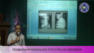 PEMBACAAN RADIOLOGI FOTO POLOS ABDOMENDIV KKD FK UMSU [upl. by Mirabel566]