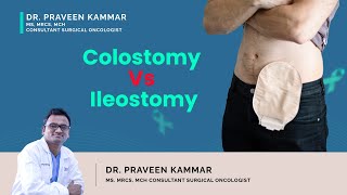 Colostomy Vs Ileostomy  Colostomy vs Ileostomy Difference  Dr Praveen Kamar Mumbai [upl. by Li]