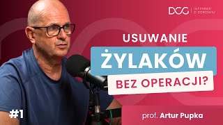 Usuwanie żylaków BEZ OPERACJI Wchodzisz i wychodzisz  Prof Pupka  Intymnie o Zdrowiu 1 [upl. by Rickie]