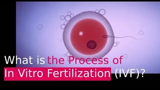 IVF PROCESS HELPFUL STEP BY STEP GUIDE In Vitro Fertilization [upl. by Zeidman470]