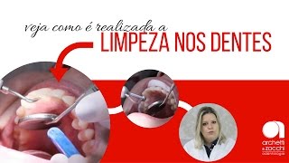 Higiene bucal veja como é realizada a limpeza dental profilaxia [upl. by Arza]