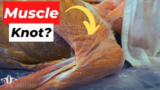 What EXACTLY Are Muscle Knots And Why Do They Happen [upl. by Broida]