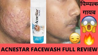 Acnestar Facewash Full review Effects and Side Effects Best for Acne क्या कील मुहासे होंगे गायब😃😰🤨🤨 [upl. by Aicul]