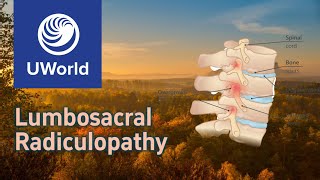 Lumbosacral Radiculopathy🍂neuroanatomy  UWorld Questions USMLE Step 1 Nervous System Neurology [upl. by Rhyner]