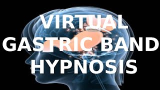 Virtual Gastric Band Hypnosis [upl. by Mullane]