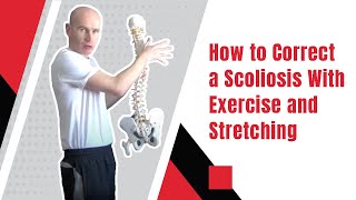 How to Correct a Scoliosis With Exercise and Stretching  Ed Paget [upl. by Eerok465]