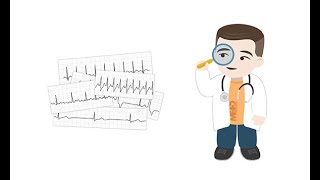 Making sense of common Holter ECG findings [upl. by Terrance]