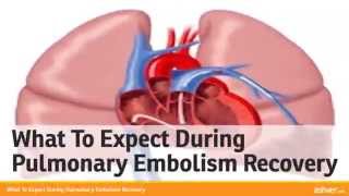 What To Expect During Pulmonary Embolism Recovery [upl. by Arrec935]