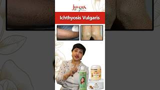 Ichthyosis Vulgaris skincare healthyskin selfcare ichthyosis skincaretips skin deadskincells [upl. by Ayyidas]