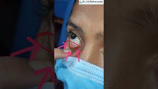 How to apply eye ointment  Simple and Correct method [upl. by Della]