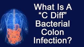 What Is A quotC Diffquot Bacterial Colon Infection [upl. by Averi950]