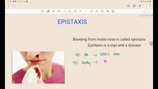 epistaxis  ENT  blood supply of nasal septum  causes  types  management [upl. by Gehman]