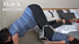 HOW TO FLIP BREECH BABY  YANELY AMADIZ [upl. by Niltyak612]