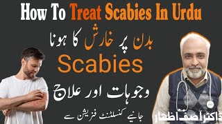 How to treat scabies  scabies treatment at home  Kharish ka ilaj  Scabies Treatment in urdu [upl. by Nilo]