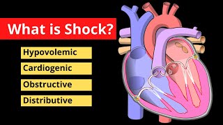 Shock Explained in 120 Seconds  Treatment Symptoms Causes  Video [upl. by Nnoryt]