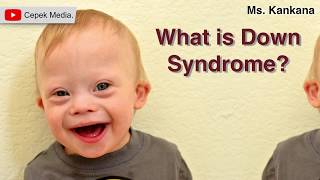 What is Down Syndrome  Biotechnology  General Medicine [upl. by Aratahs]