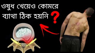 Lumbar Disc Herniation Treatment  World Class Spine Treatment in Durgapur PTAnindya [upl. by Cocke308]