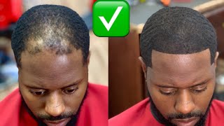 CLEAN HAIRCUT FIX FOR BALDING MEN  HAIR FIBERS [upl. by Lanti]