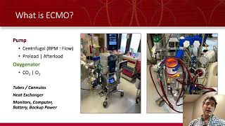 ECMO A Simple Approach to the Equipment [upl. by Suoicerp]