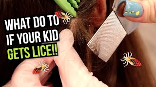 What to do if your Kid Gets Head Lice [upl. by Nitas]