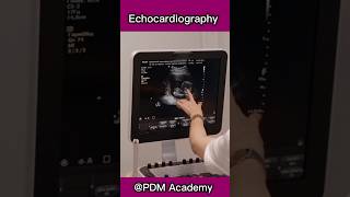 Echocardiography  an ultra sound for heart ❤️  Test and procedure [upl. by Nahtaj]