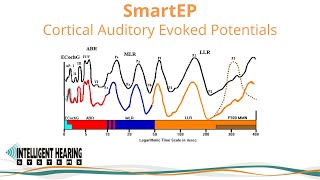 SmartEP Overview of Cortical Auditory Evoked Potential options [upl. by Matejka643]