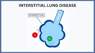 Interstitial Lung Disease Explained [upl. by Ordisy977]