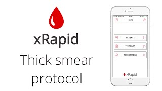 How to Thick Smear Protocol [upl. by Takeshi]