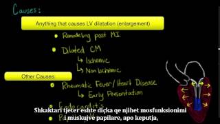 Semundja e valvulave te zemres regurgitimi i valvules mitral dhe prolapsimi i valvules mitrale 7 [upl. by Enrak]