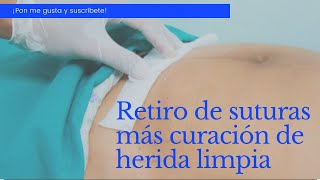 RETIRO DE SUTURAS Y CURACIÓN DE HERIDA LIMPIA [upl. by Adile547]