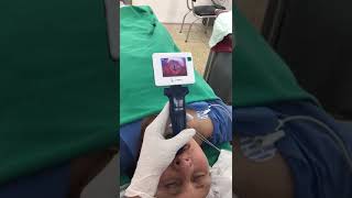 Video Laryngoscopy intubation for an Adult Patient [upl. by Jeniece]